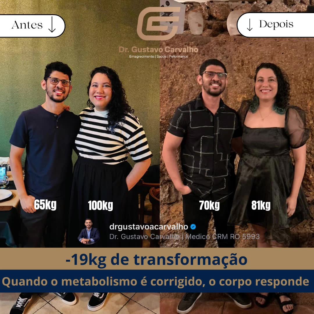 Felipe e Bruna Antes e Depois